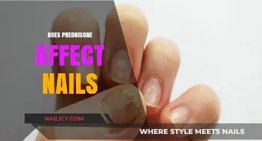 Prednisone and Nail Health: Potential Side Effects Explained