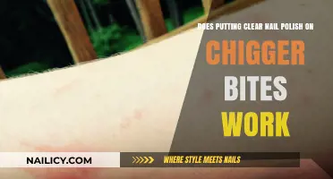Clear Nail Polish on Chigger Bites: Effective Remedy or Myth?