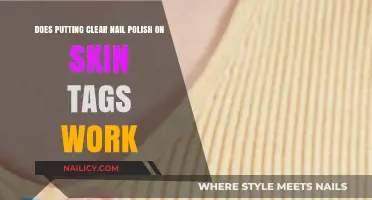 Clear Nail Polish on Skin Tags: Fact or Fiction?
