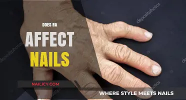 Rheumatoid Arthritis and Nail Health: Symptoms, Causes, and Care Tips