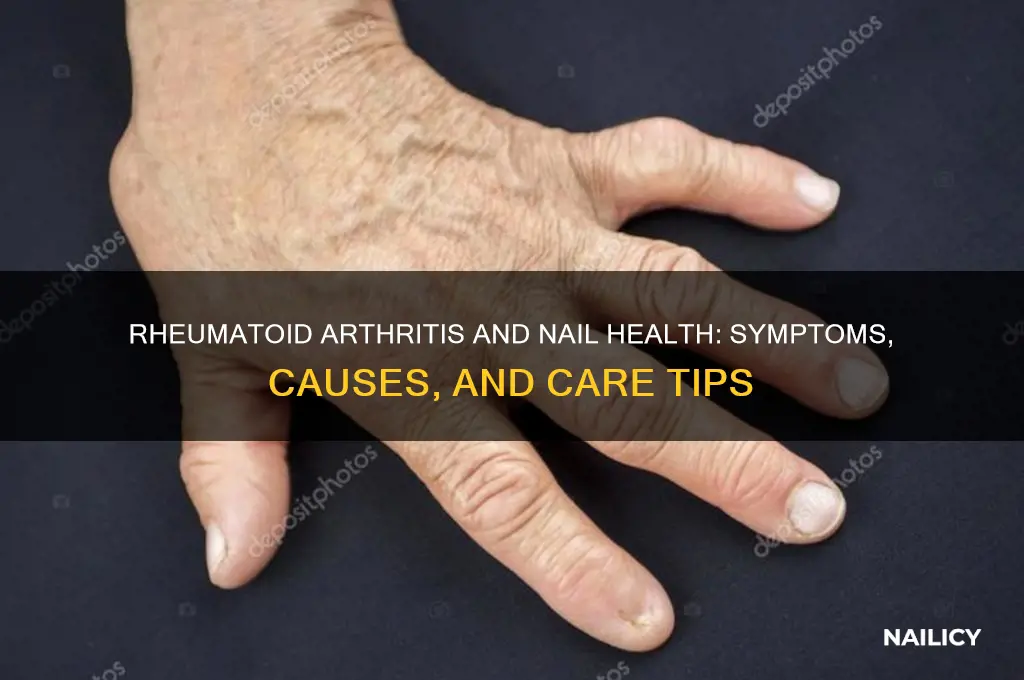does ra affect nails