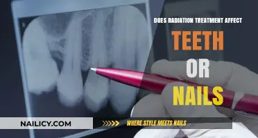 Radiation Therapy's Impact: How It Affects Teeth and Nails