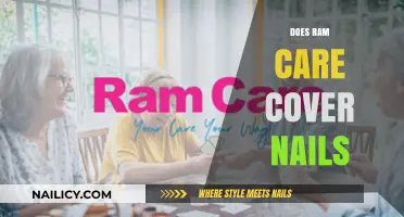 Does RAM Care Cover Nails? Understanding Your Warranty and Repairs