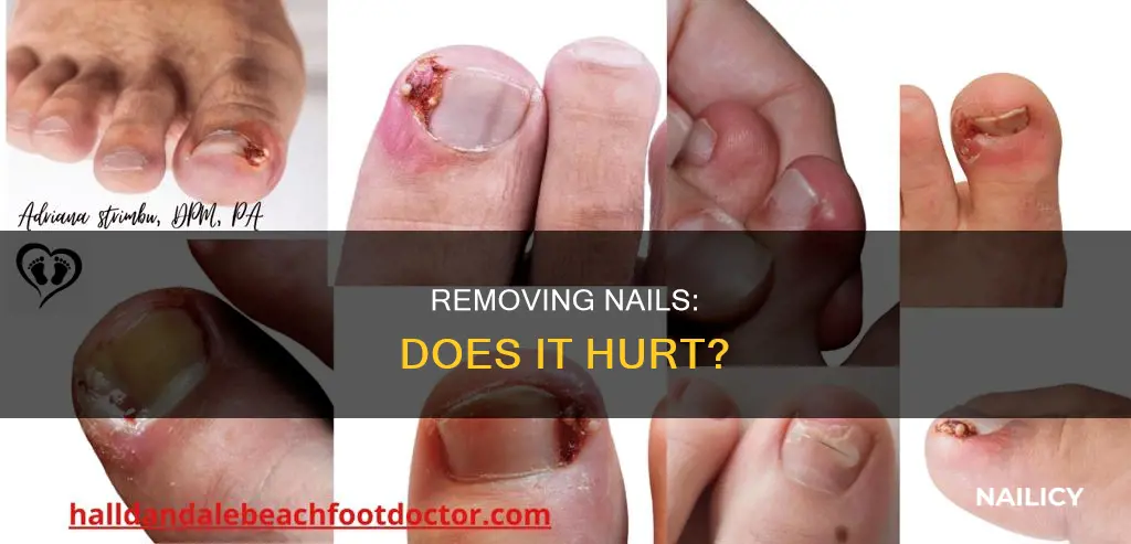 does removing a nail hurt