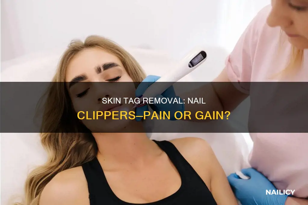 does removing a skin tag with nail clippers hurt