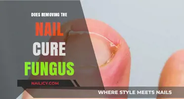 Killing Nail Fungus: Removal or Treatment?