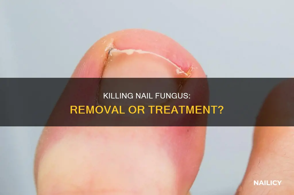 does removing the nail cure fungus
