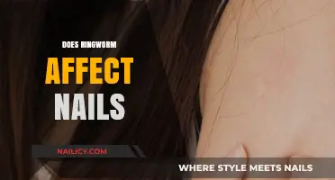Can Ringworm Infect Your Nails? Symptoms, Causes, and Treatments Explained