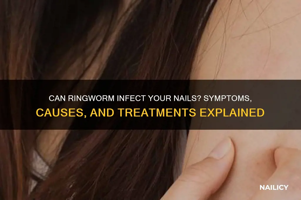 does ringworm affect nails