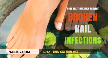 Salt Soaks for Broken Nails: Infection Prevention Tips and Benefits