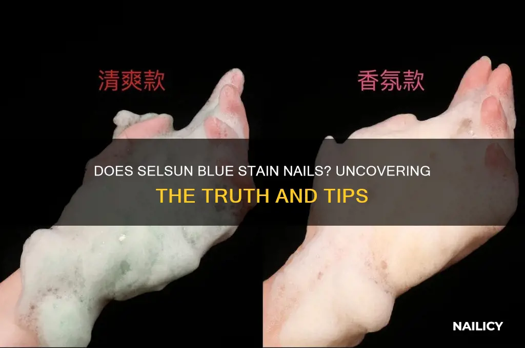 does selsun blue stain nails