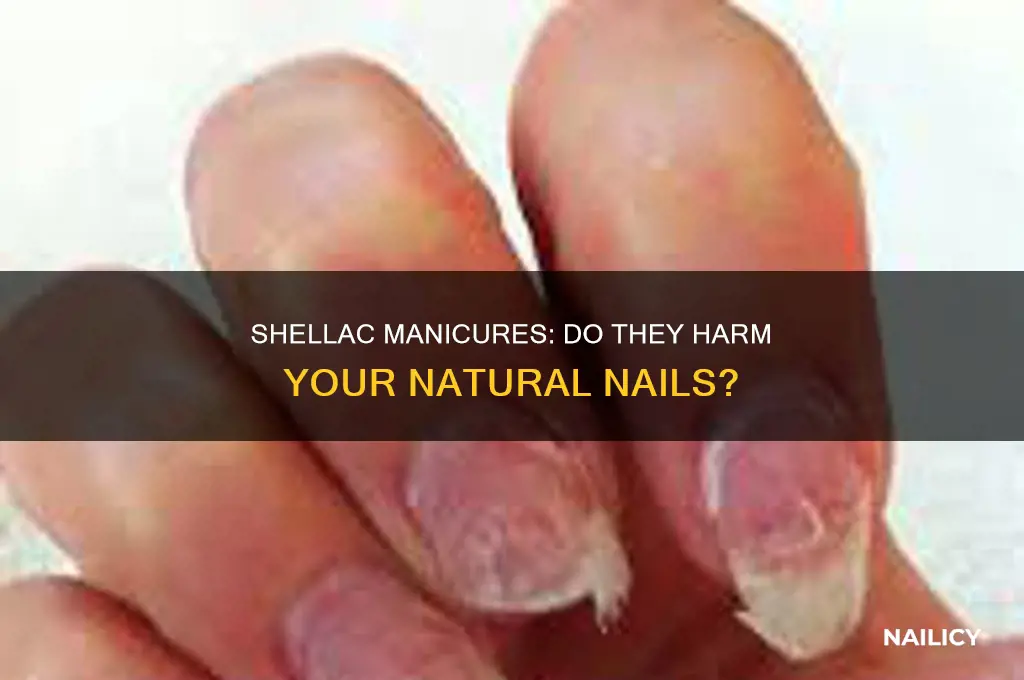 does shellac damage natural nails