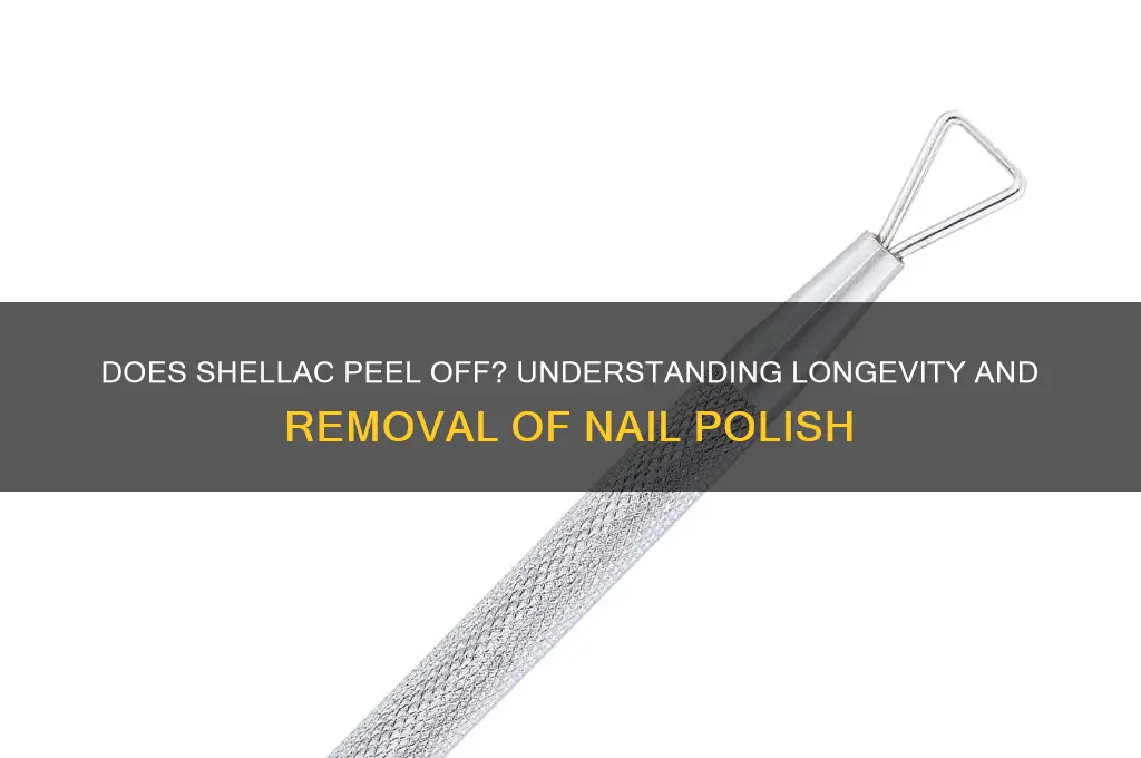 does shellac nail polish peel off