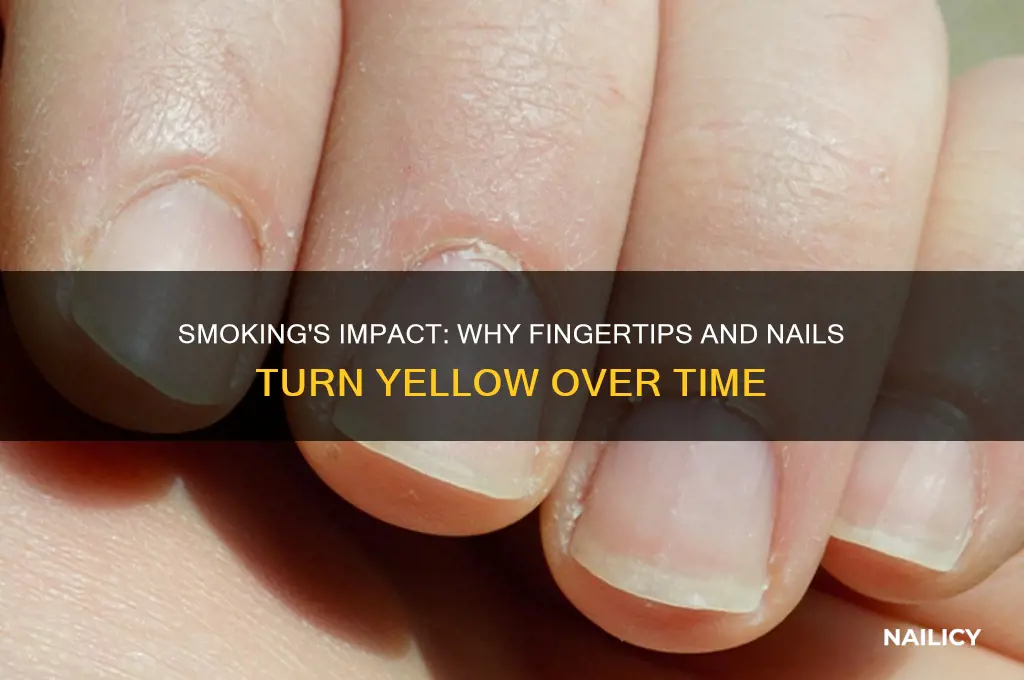 does smoking turn fingertips and nails yellow