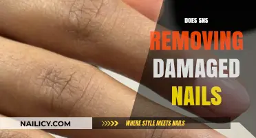 SNS Nails: Damaged Nails Removal Solution