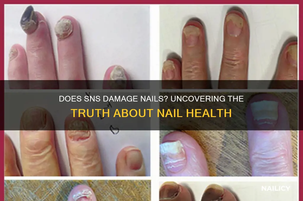 does sns ruin your nails
