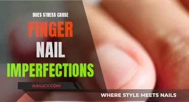 Stress and Nails: Imperfections and Their Causes