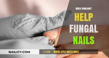 Sunlight's Role in Treating Fungal Nails: Myth or Effective Remedy?