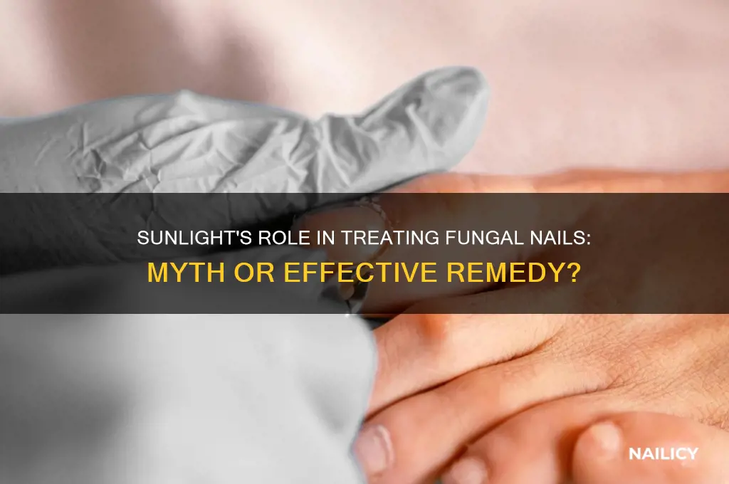 does sunlight help fungal nails