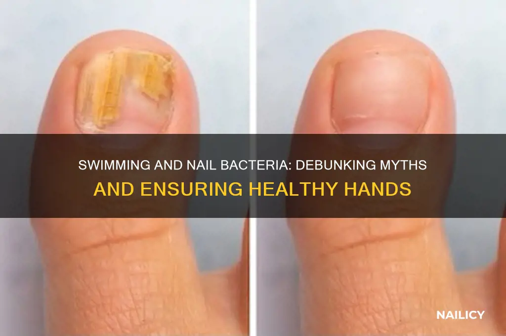 does swimming give bacteria in your nails