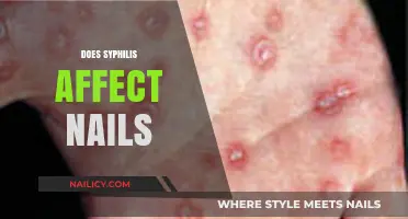 Syphilis and Nail Health: Uncovering the Surprising Connection and Symptoms
