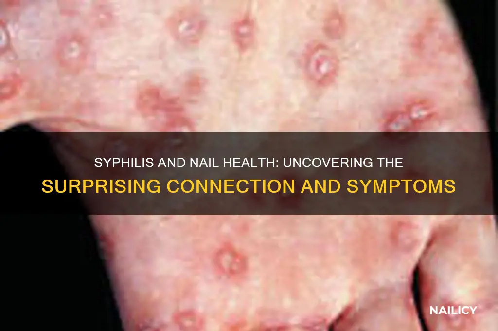 does syphilis affect nails