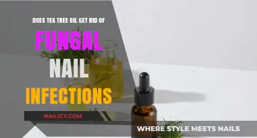 Natural Remedies: Tea Tree Oil's Efficacy Against Fungal Nail Infections