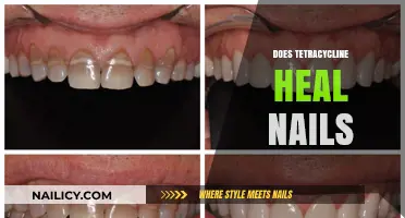Can Tetracycline Effectively Treat and Heal Damaged or Infected Nails?