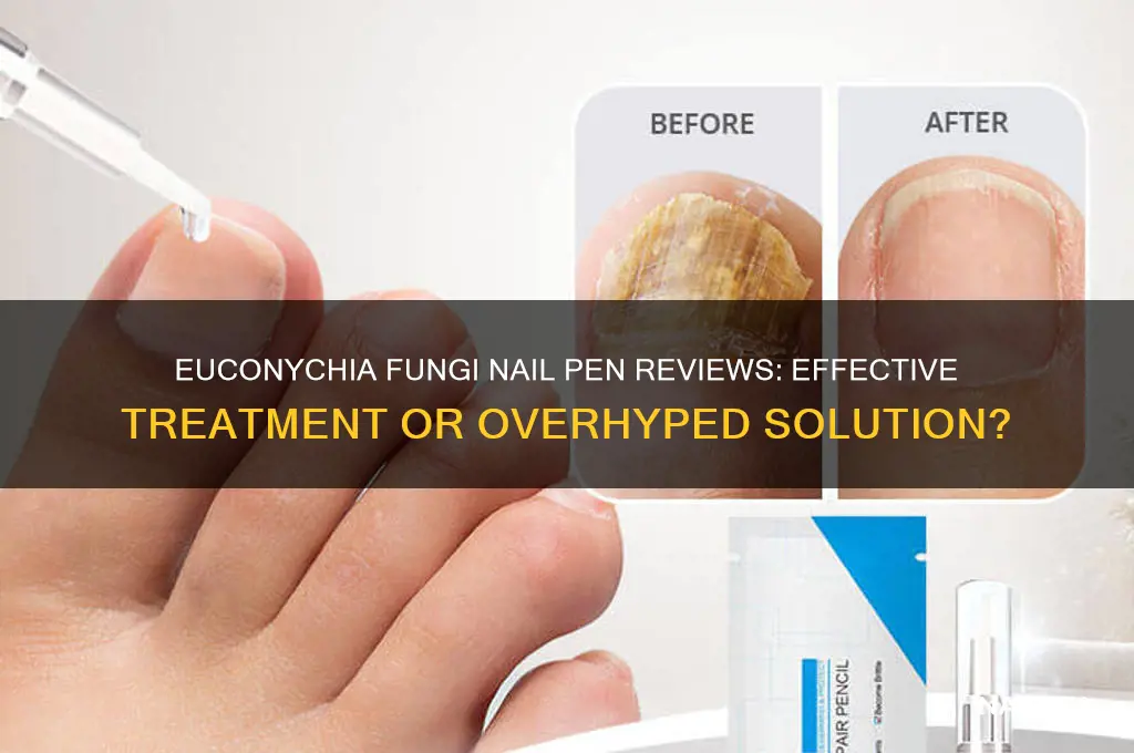 does the euconychia fungi nail pen reviews