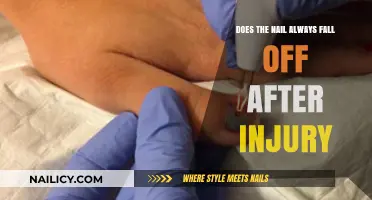 Nail Injury Aftermath: Will It Always Fall Off After Trauma?