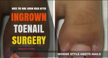 Ingrown Toenail Surgery: Will My Nail Grow Back?