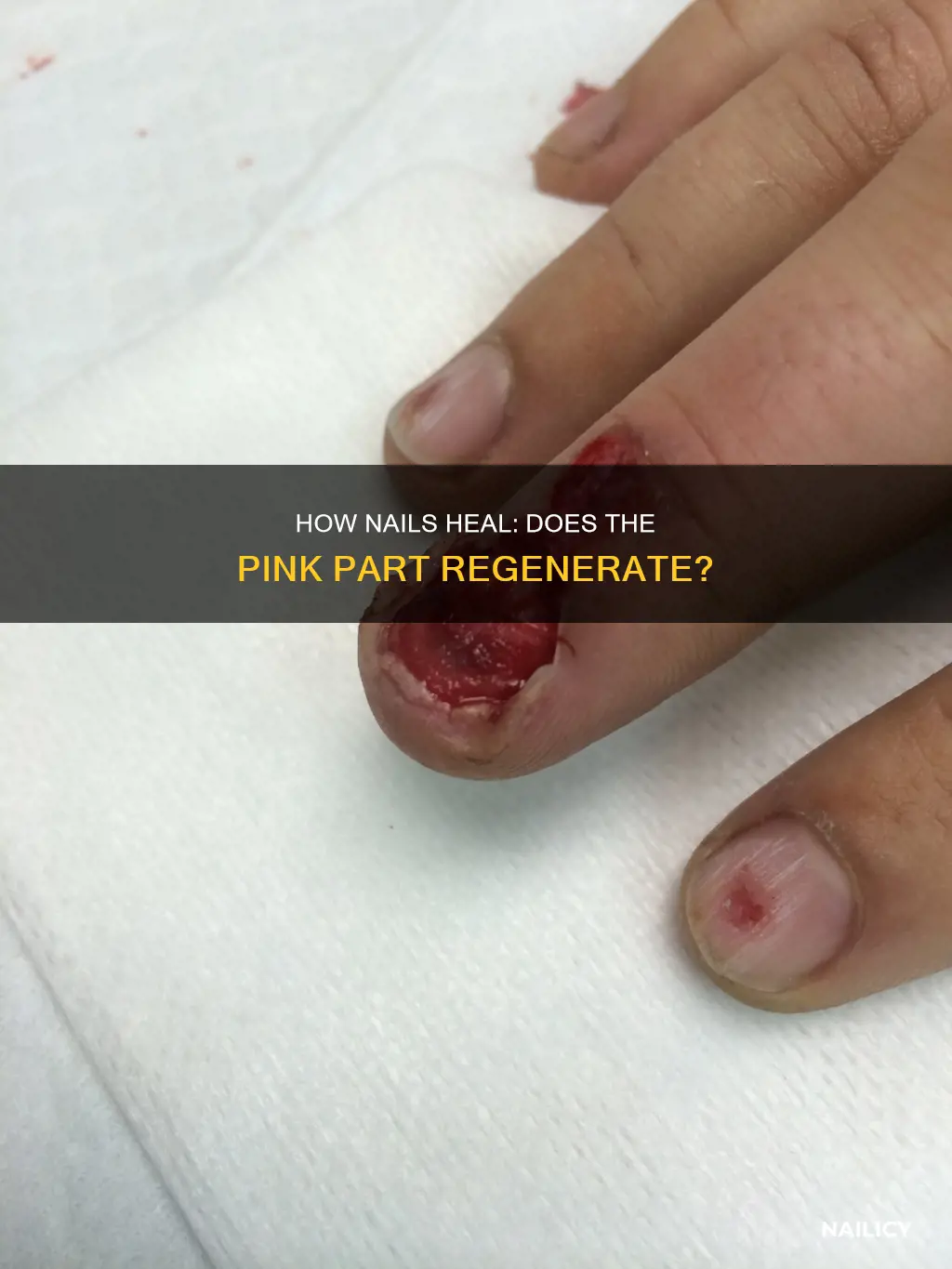 does the pink part of the nail grow back
