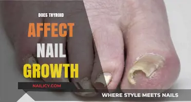 Thyroid and Nail Health: Uncovering the Connection to Growth Patterns