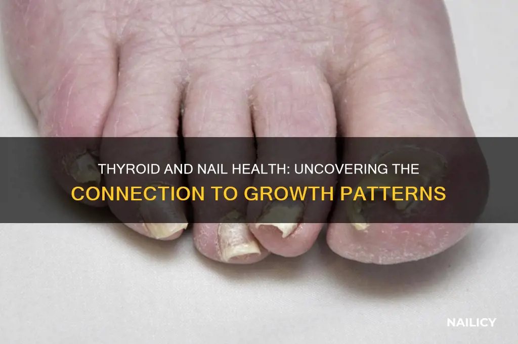 does thyroid affect nail growth