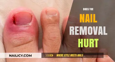 Toe Nail Removal: Is It Painful?