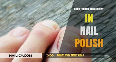 Can Toenail Fungus Survive in Nail Polish? Uncovering the Truth