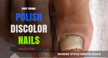 Toenail Polish Discoloration: Causes, Prevention, and Healthy Nail Care Tips