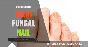 Tolnaftate for Fungal Nails: Effective Treatment or Just a Myth?