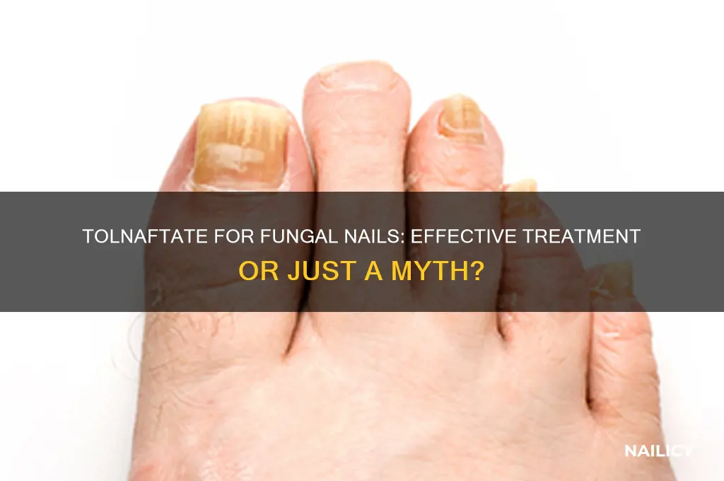 does tolnaftate treat fungal nail