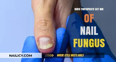 Natural Remedies for Nail Fungus: Does Toothpaste Really Work?