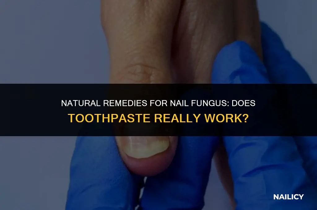 does toothpaste get rid of nail fungus