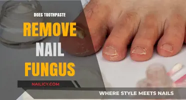 Toothpaste: A Nail Fungus Remedy?