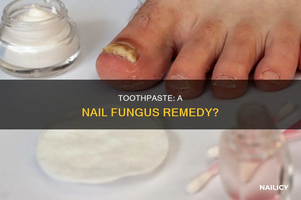 does toothpaste remove nail fungus