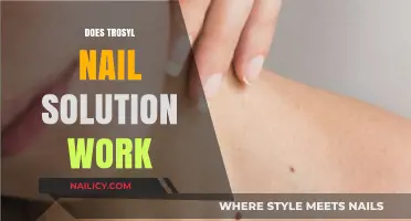 Trosyl Nail Solution Review: Does It Effectively Treat Fungal Infections?