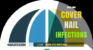 Does UHC Cover Nail Infections? Understanding Your Insurance Benefits