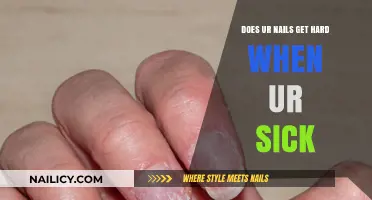 Nail Health and Illness: Understanding the Connection