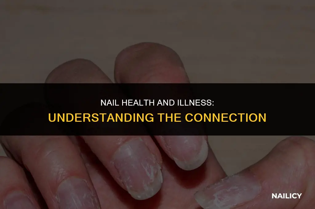 does ur nails get hard when ur sick
