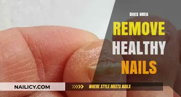 Urea's Impact: Healthy Nails Removal and More