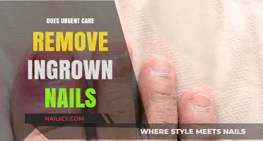 Ingrown Nails: Can Urgent Care Help?
