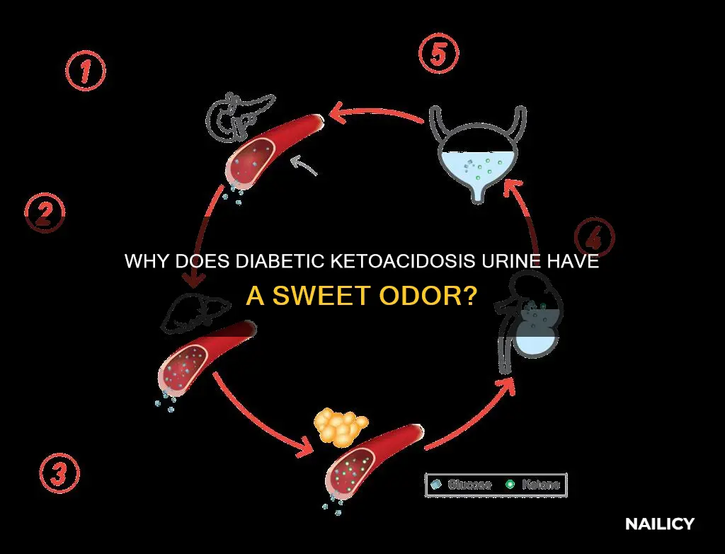 does urine from diabetic ketoacidosis smell like nail polish remover